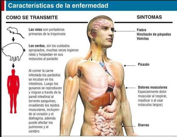 Síntomas.