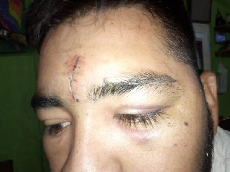 Joven fue brutalmente golpeado por una patota