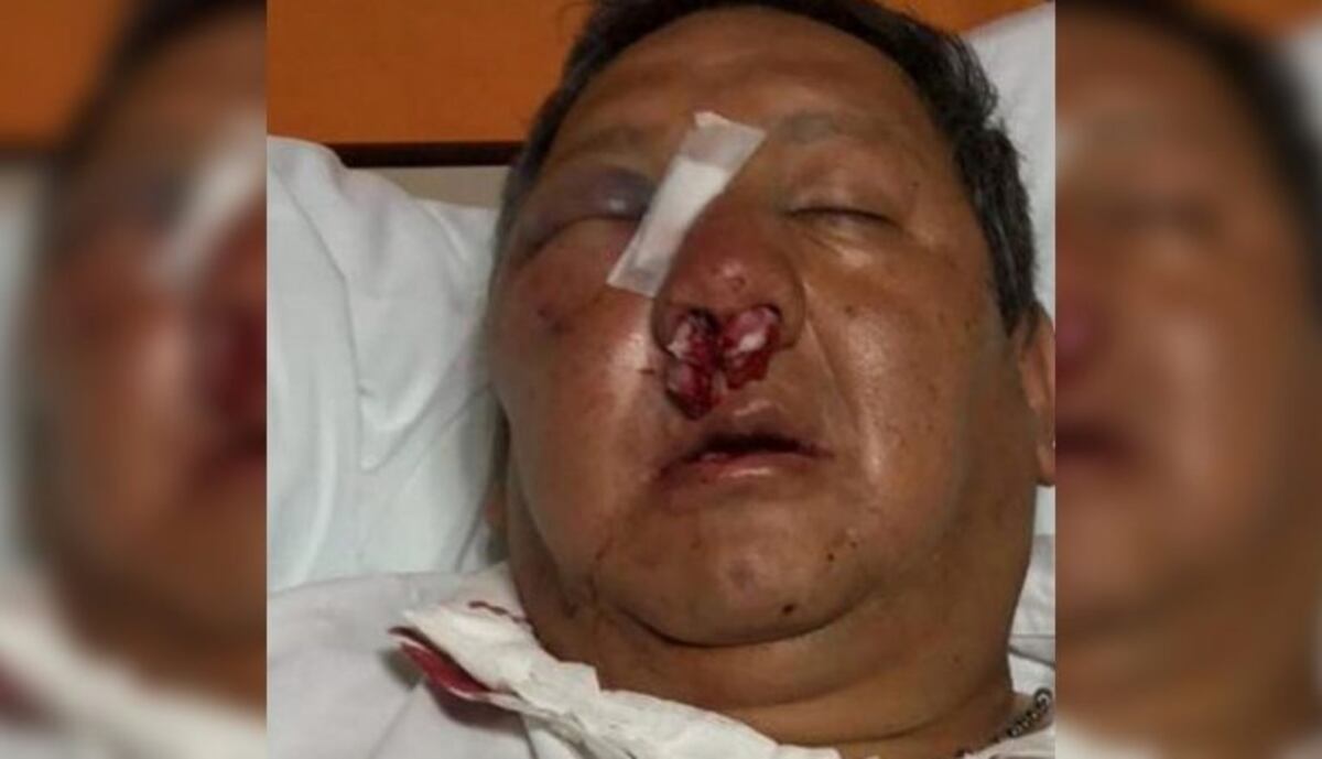 Un vendedor ambulante atacó brutalmente a un inspector de tránsito