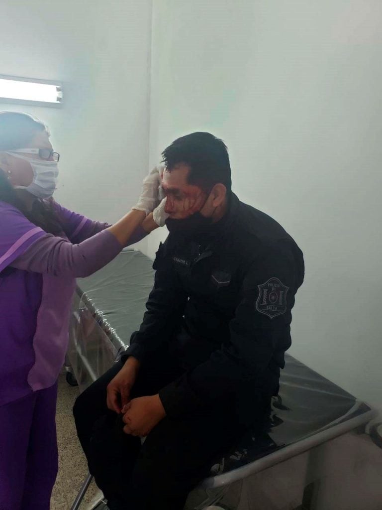 Brutal ataque a policías que intentaron parar un partido de fútbol. (Policía de Salta)