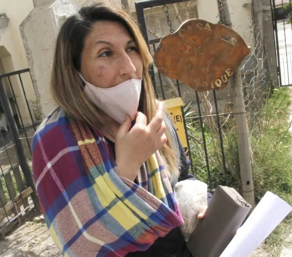 El drama de una hockista sanjuanina que se fracturó el hombro por un ataque de motochorros