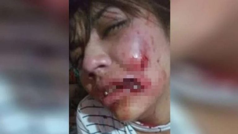 La joven agredida en Neuquén (Foto: La Mañana de Neuquén).