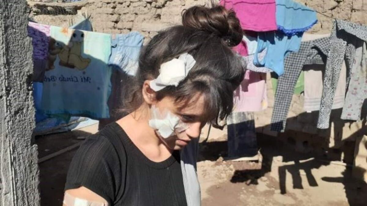 La confundieron con otra y la apuñalaron: "No sé cómo voy a mirar a mi hijo"