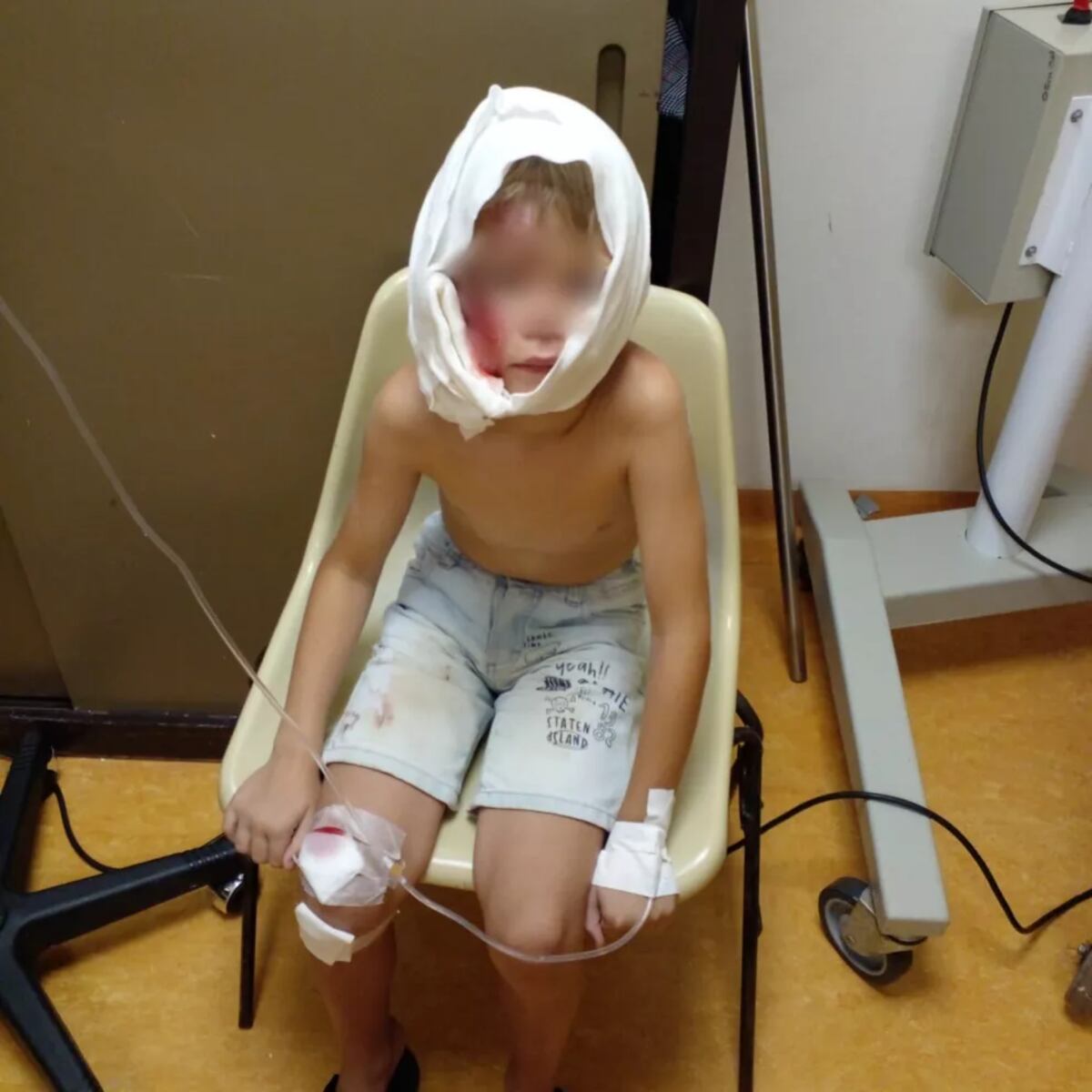 Oberá: un niño de 7 años resultó seriamente herido tras el ataque de un rottweiler