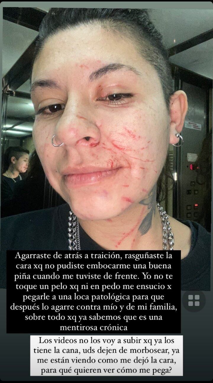 Así quedó el rostro de la hermana de Cazzu tras la discusión.