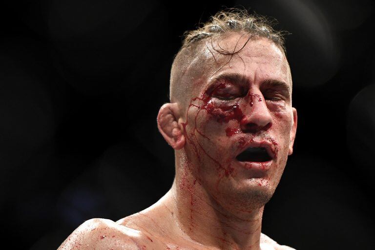 Así quedó el rostro de Niko Price (Foto: Douglas P. DeFelice/Getty Images/AFP)