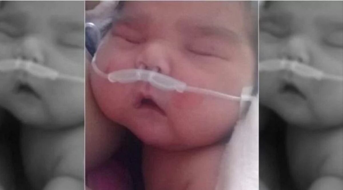 El super bebé sanjuanino está en Terapia Intensiva por problemas respiratorios