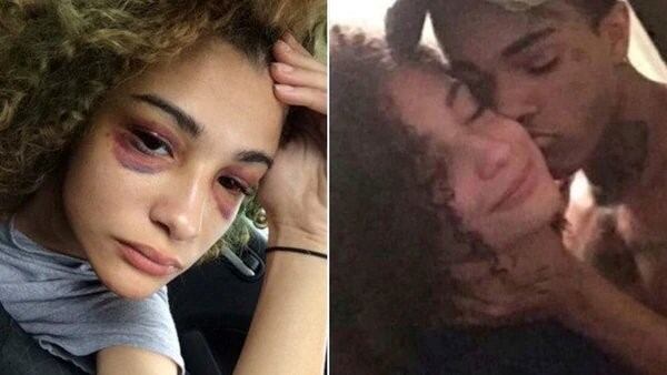 Agresiones de XXXTentacion a su novia embarazada