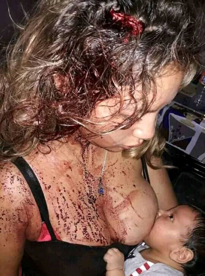 La joven Maira Antonella Rodríguez luego de la brutal agresión. (Facebook)