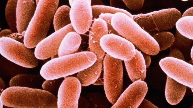 La listeriosis es un microorganismo que puede causar infecciones, a veces graves, en personas susceptibles.