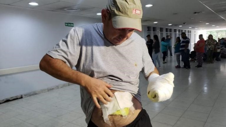 Un empleado de Defensa Civil de la Municipalidad de Córdoba resultó herido por la pirotecnia. (El Doce TV)