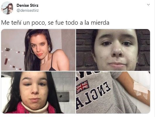 La joven Denise Stirz recurrió a las redes sociales para contar un episodio que sufrió: se tiñó el pelo de negro y terminó internada.