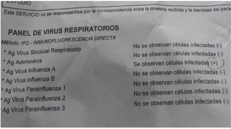 Análisis dio positivo Gripe A.