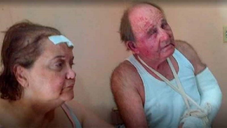 Pareja de jubilados jujeños agredidos.