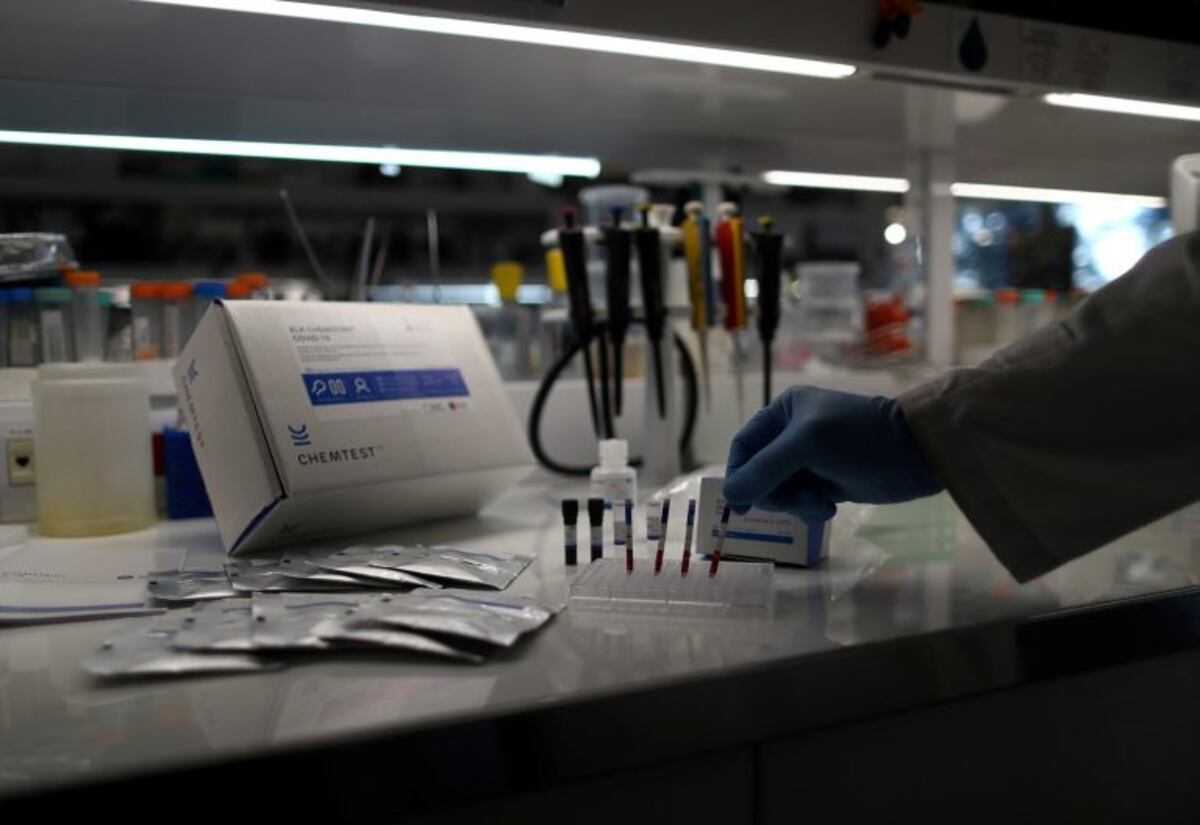 Se realizaron más de 100.000 ensayos en el país con el test serológico para detectar anticuerpos en el plasma