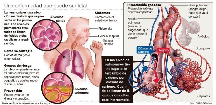 En el país hay 150.000 casos y la mortalidad alcanza el 38%.