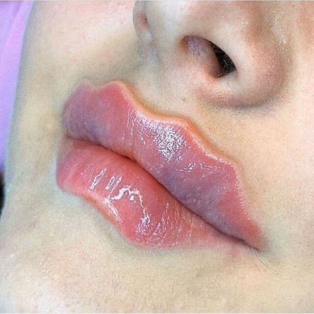 "Labios del Diablo": la peligrosa tendencia que se volvió viral en internet (Foto: Instagram/ #devillips)