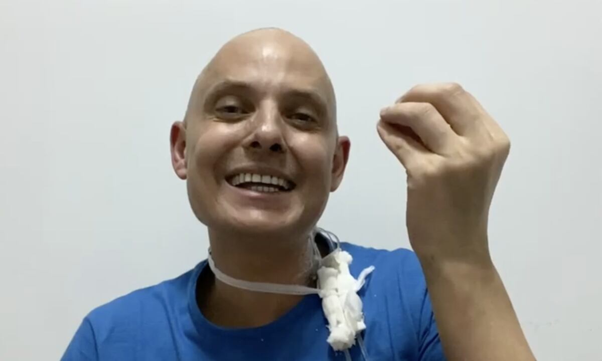 Lío Pecoraro compartió en las redes su mejoría de la leucemia: “Pelito creciendo”
