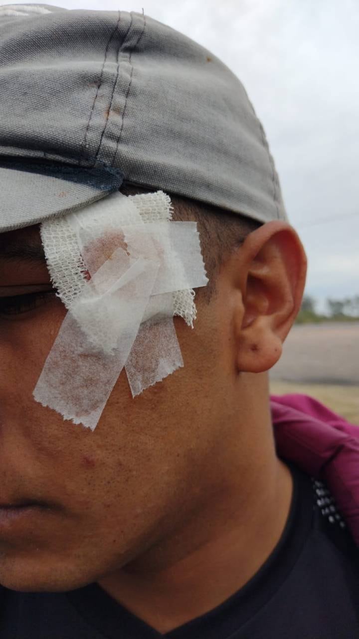 Entre los lesionados se cuentan al menos tres personas heridas de bala.