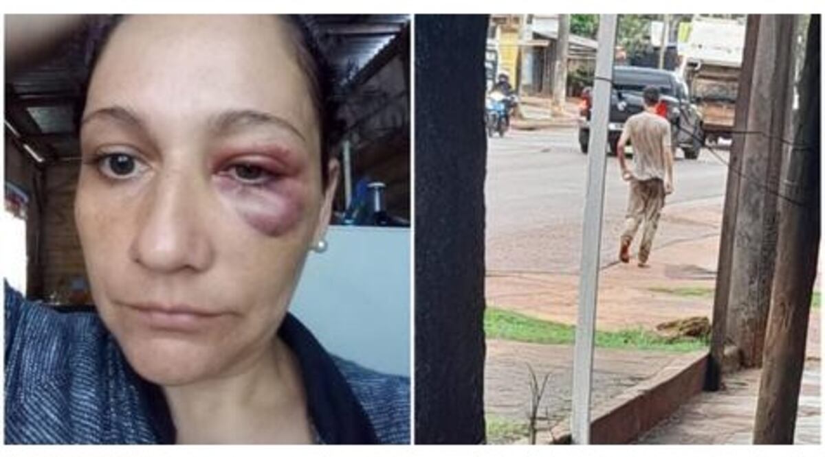 Posadas: joven con presuntos problemas mentales golpeó a una mujer en plena vía publica