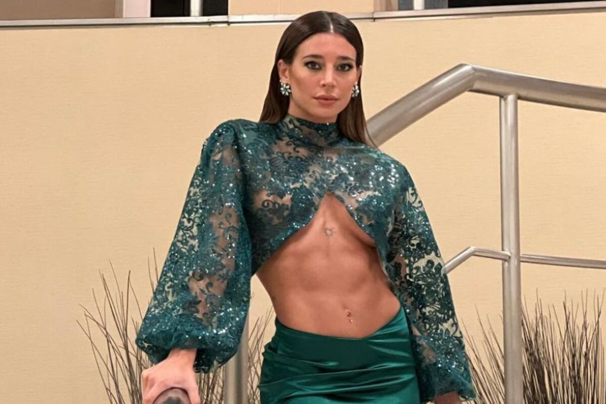 Sol Pérez mostró en Instagram su retoque estético definitivo