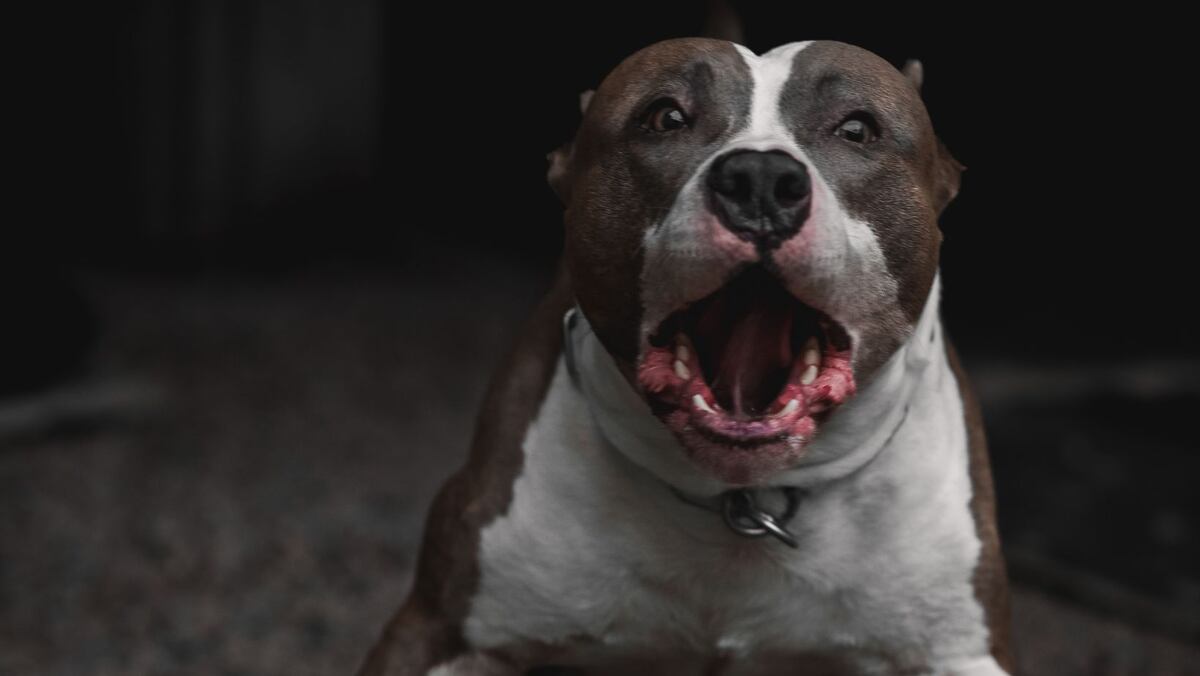 Terrible ataque de pitbull dejó a dos mujeres heridas de gravedad en Santa Fe