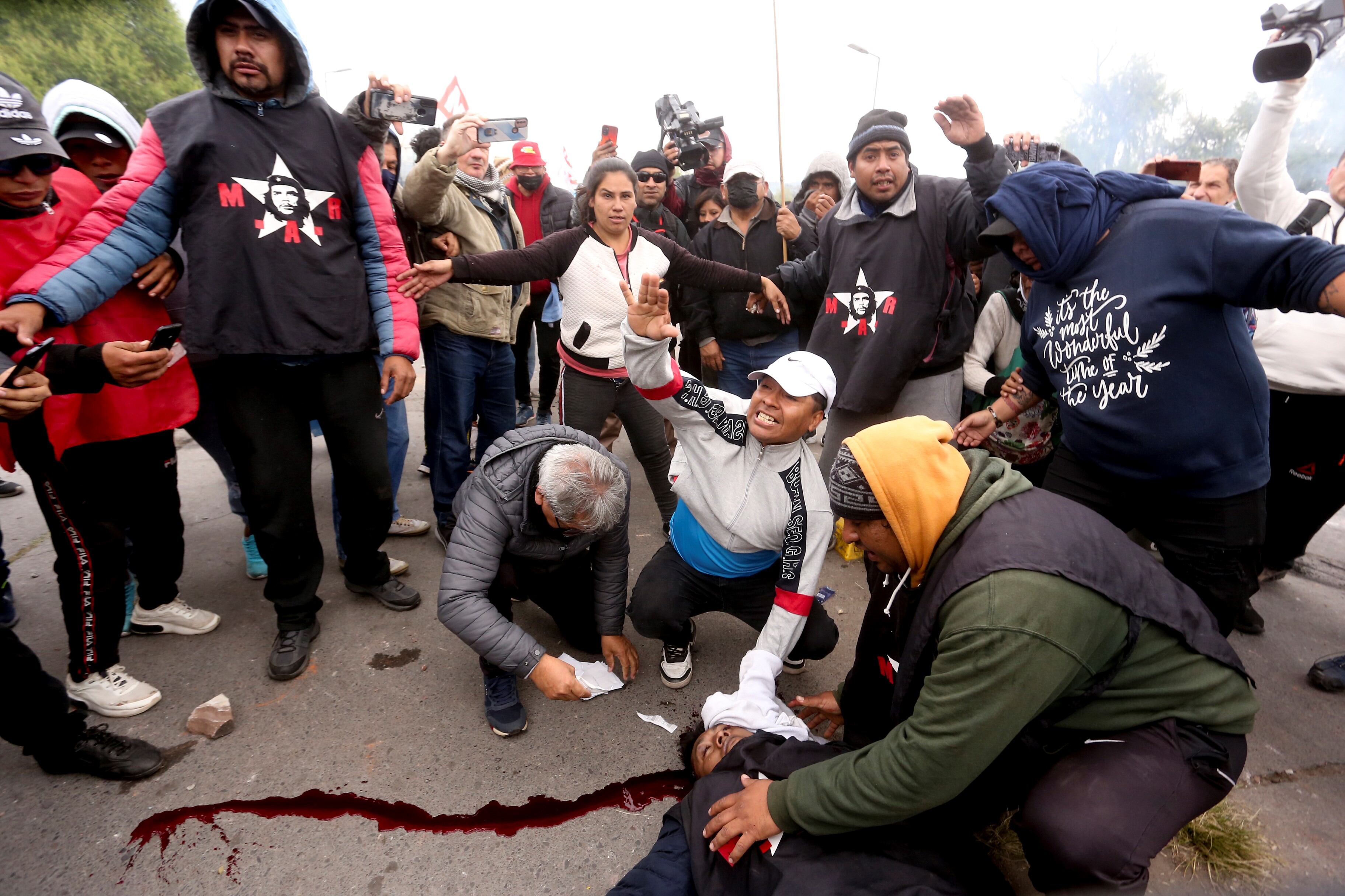 Un manifestante es atendido por sus compañeros tras haber resultado herido en la cabeza en medio de los disturbios desatados este martes en San Salvador de Jujuy.