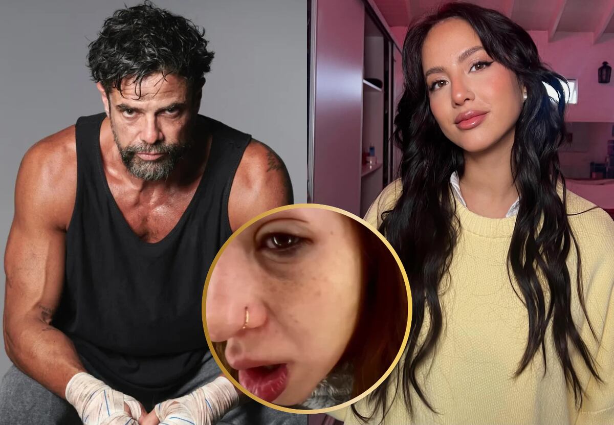 El impactante video de Flor Vigna con la cara desfigurada luego de su separación: “No me animaba a...”