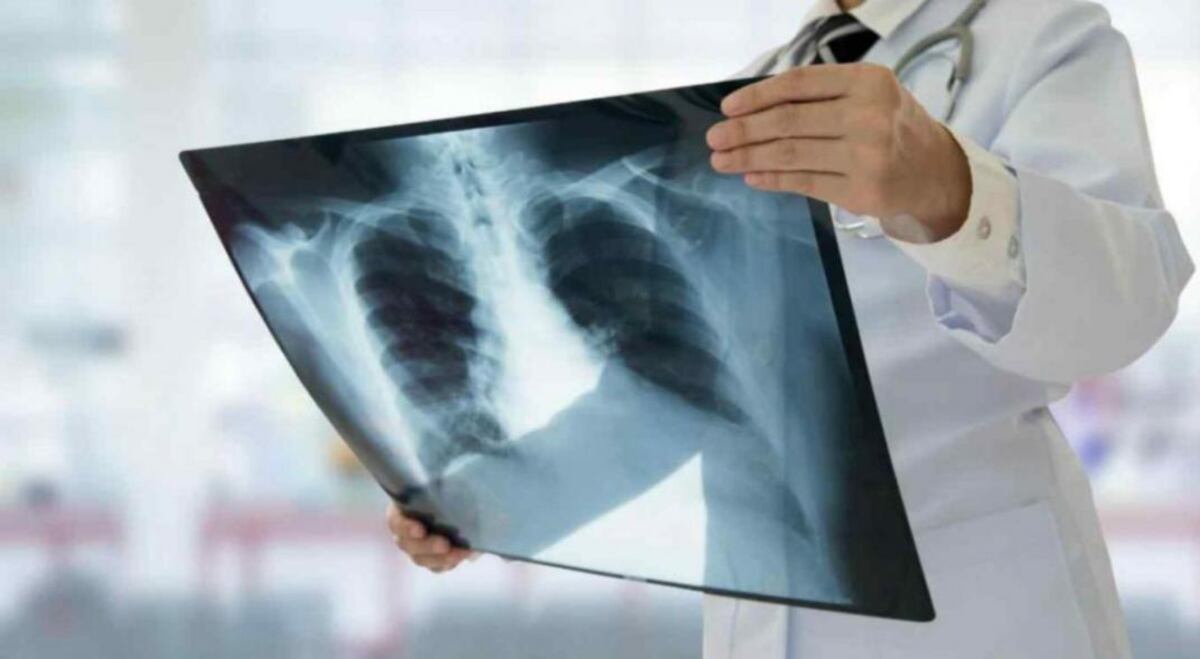 El hospital “Dr. Jaime Ferré” concientiza sobre la Tuberculosis