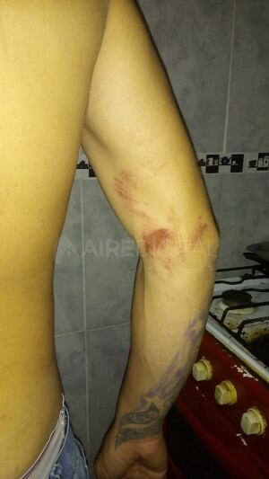 Dos jóvenes golpeados en una comisaría de Santa Fe. (Aire de Santa Fe)