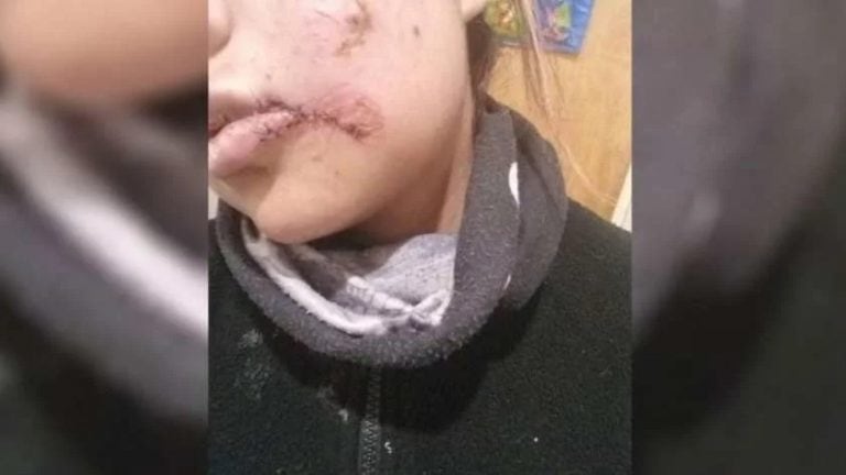 La joven agredida en Neuquén (Foto: La Mañana de Neuquén).