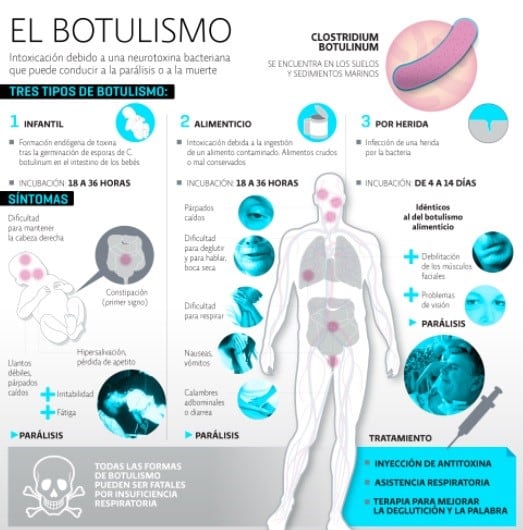 El Botulismo