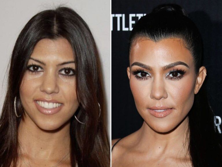 Las Kardashian antes y después (web)