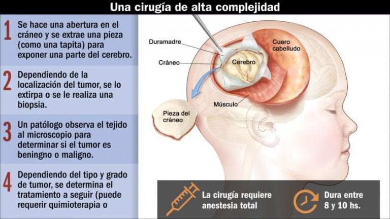 Una craneotomía de alta complejidad. (CEDOC)