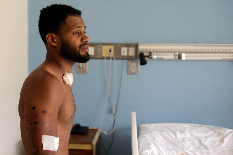 Uno de los heridos durante las protestas (REUTERS/Manaure Quintero)