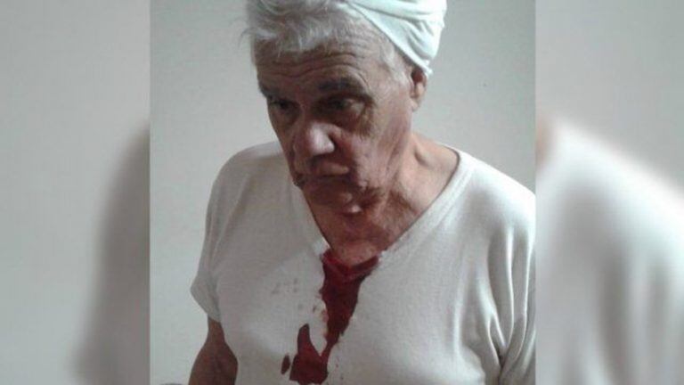 Mario Kovacevich, de 77 años, fue empujado por un policía en Santa Isabel y terminó con un corte en la cabeza. (Twitter)