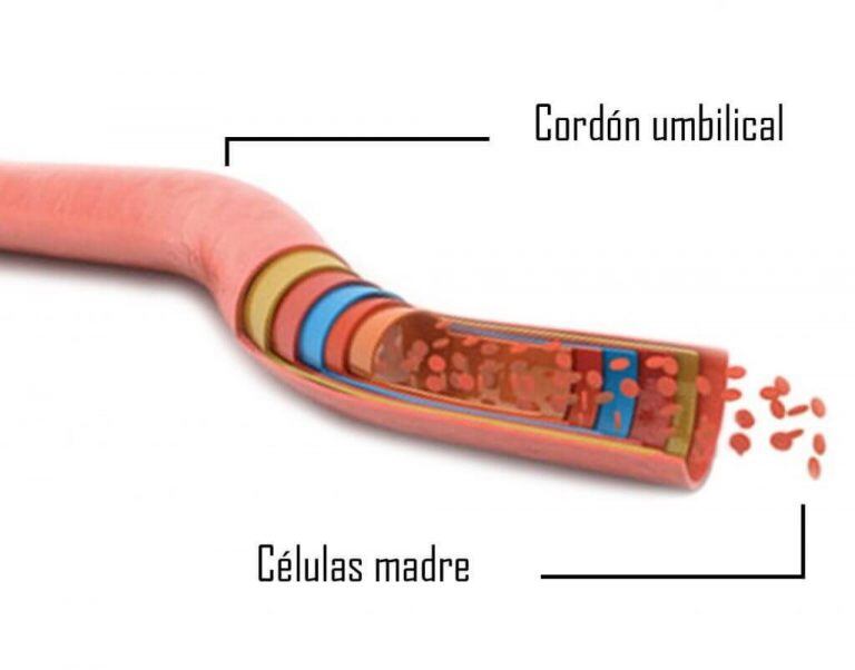 Cordón umbilical