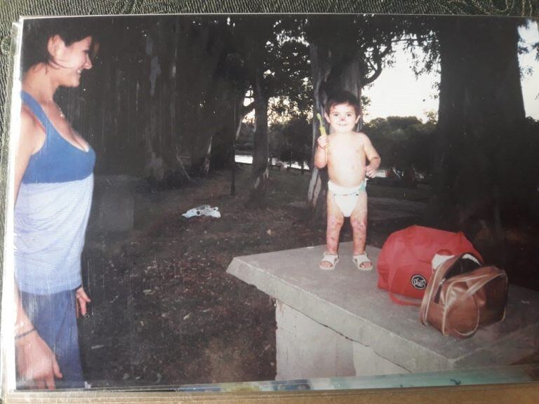 Juampi Gaetán, el niño con piel de cristal