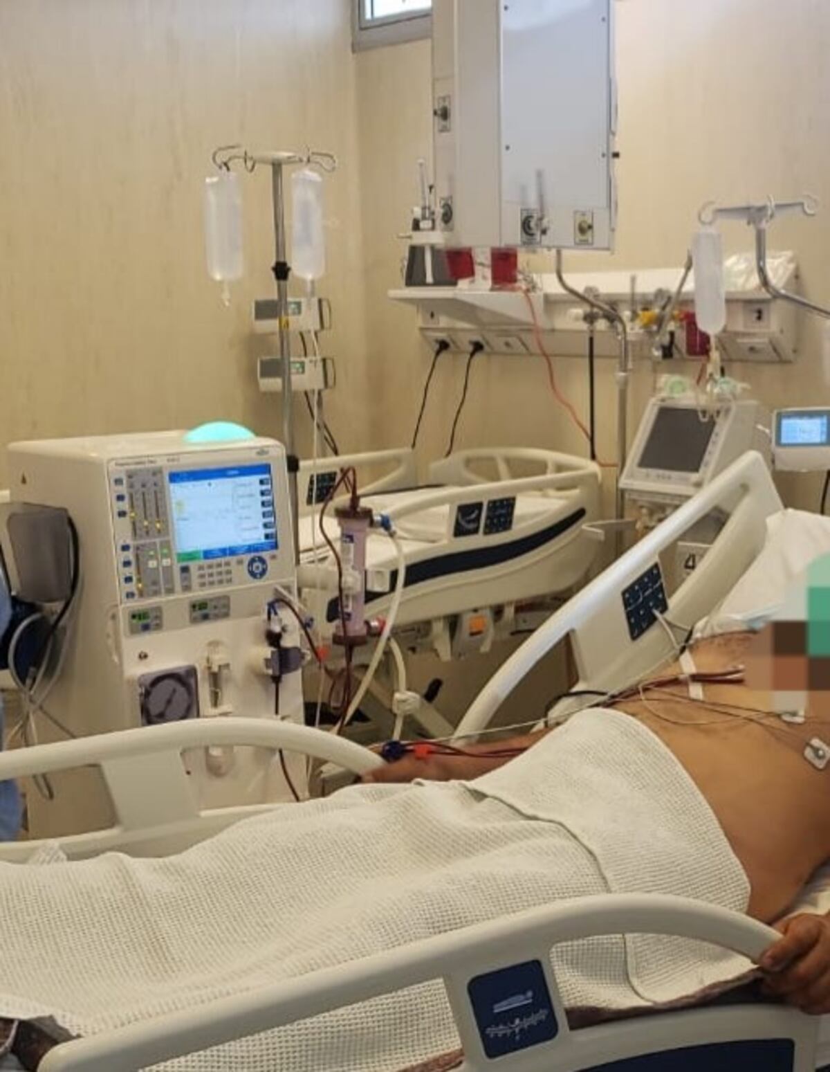 Rafaela realiza la primera diálisis en el sistema público de salud