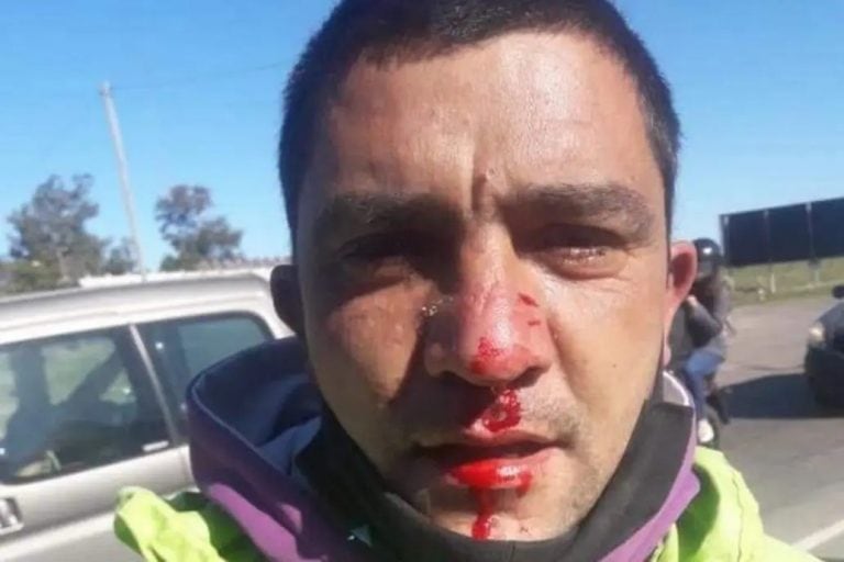 El guardia agredido (Foto: municipalidad de Baradero)