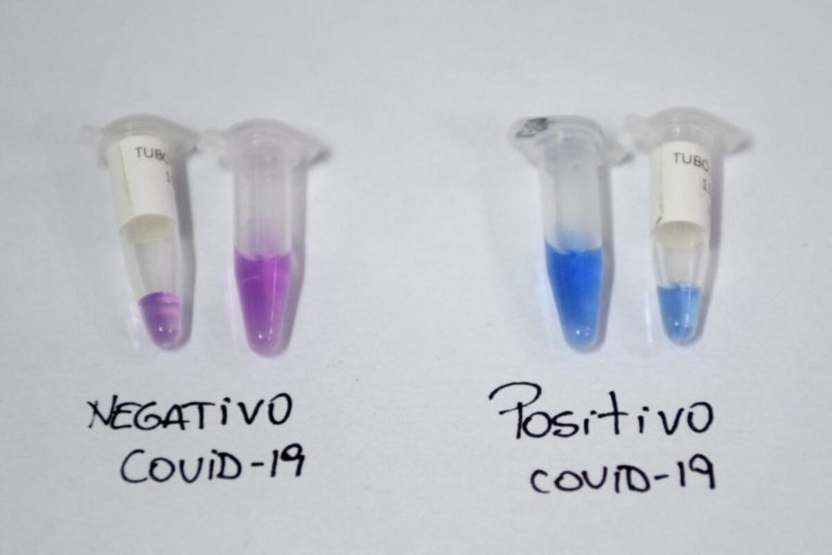 Tres nuevos casos de coronavirus en Santa Fe, todos de Rosario