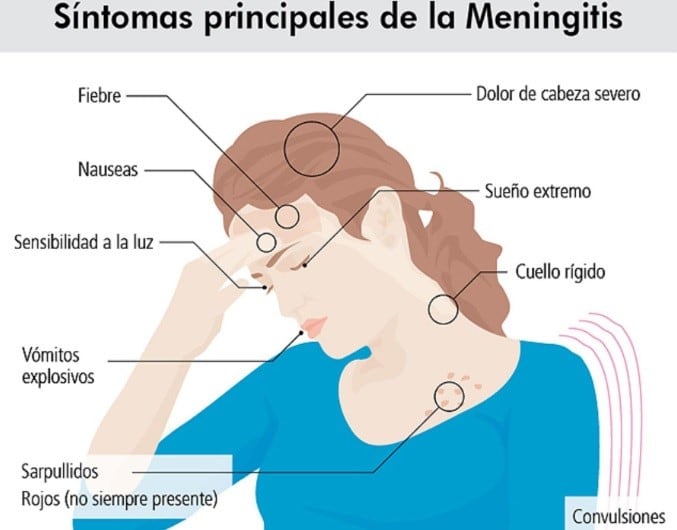 Meningitis