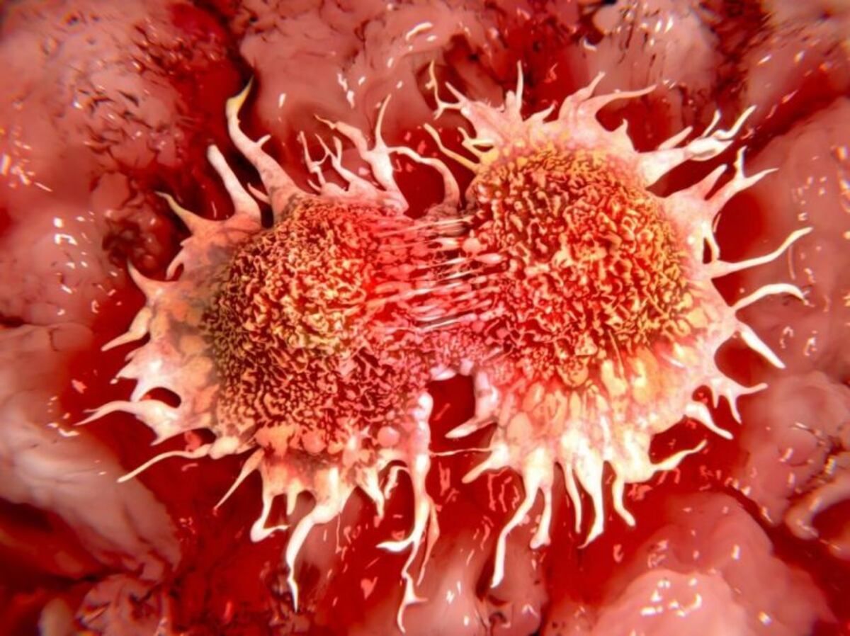 Cáncer: informarse en Carlos Paz