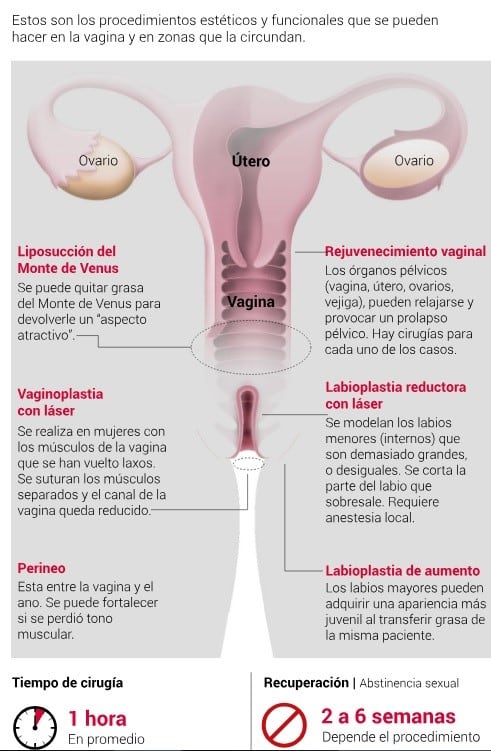 (Fuente: Clarín)