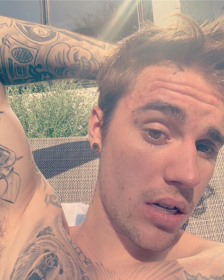 La dentadura de diamantes de Justin Bieber (Foto: Instagram)