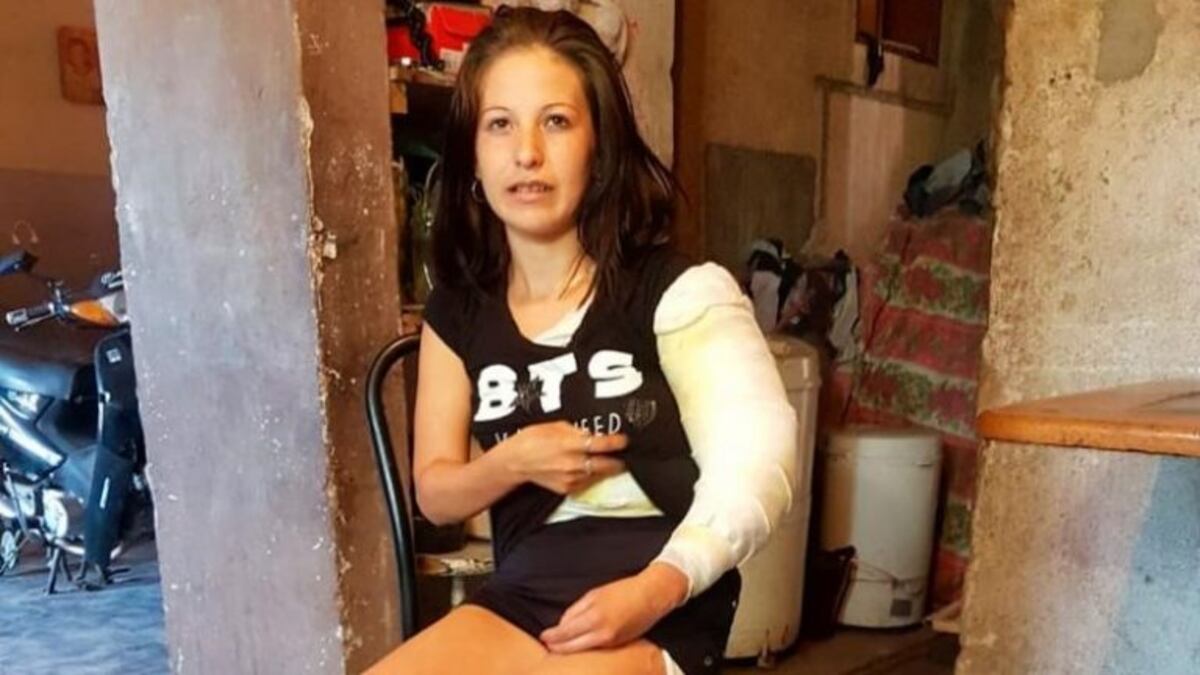 Su pareja la roció con alcohol y le prendió fuego: "Pensé que me moría, me tiré abajo de un pico"