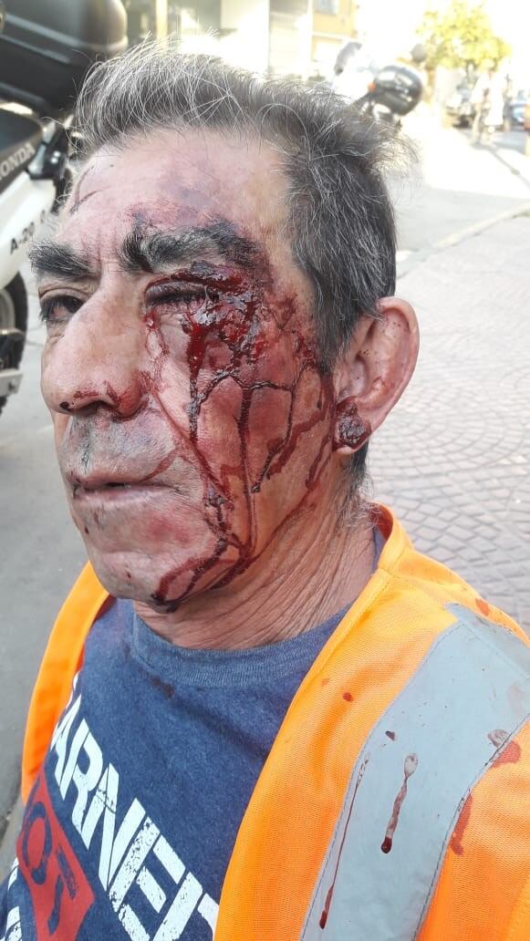 Así había quedado el "naranjita" agredido en Carlos Paz.