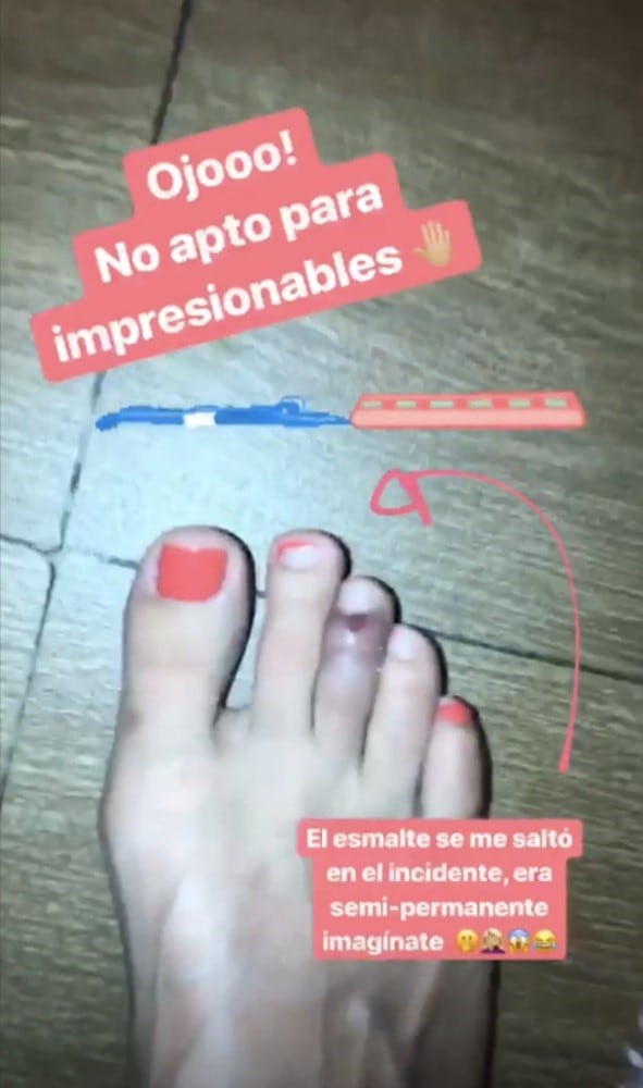 Florencia Bertotti compartió con sus seguidores el doloroso accidente que sufrió durante sus vacaciones en México. Instagram/florbertottiok