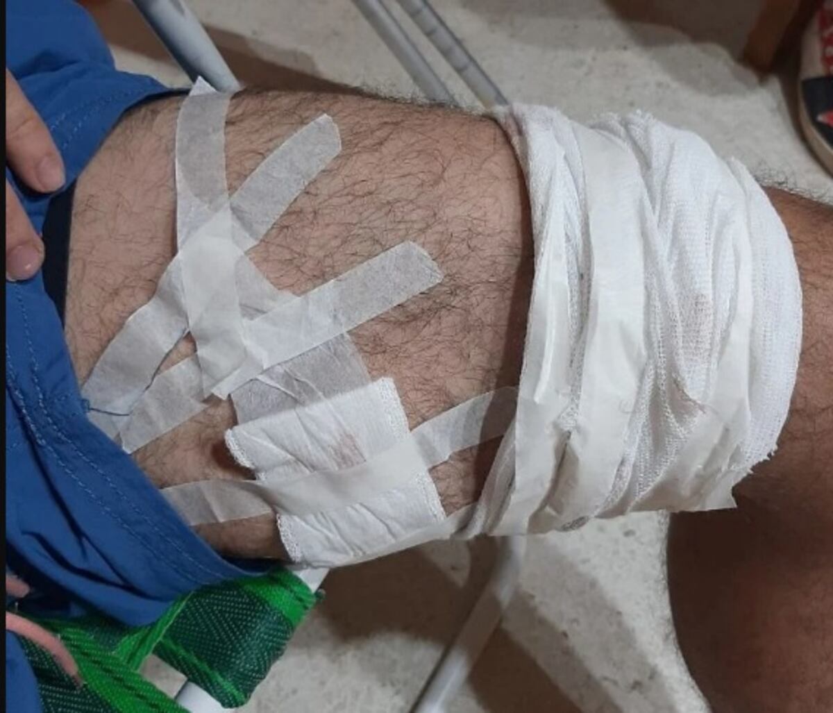 Su ex cuñado le dio un balazo en la rodilla y lo dejó hospitalizado