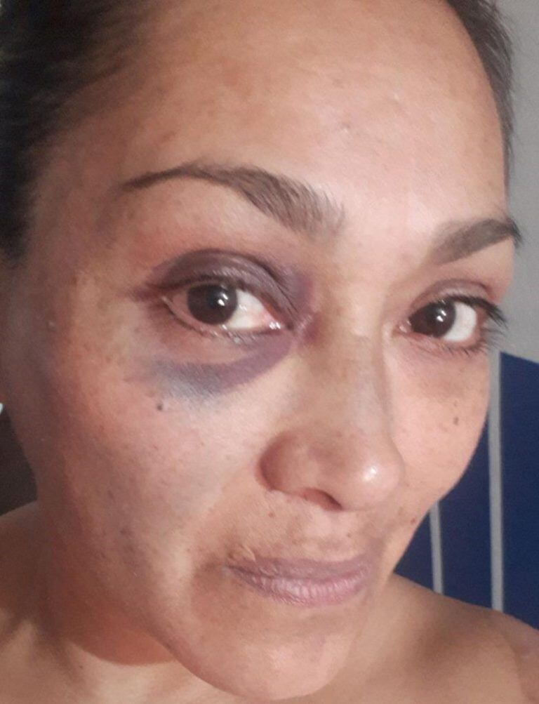 La suboficial Flavia Tejada fue una de las agredidas y los médicos evalúan una posible lesión en el hombro derecho